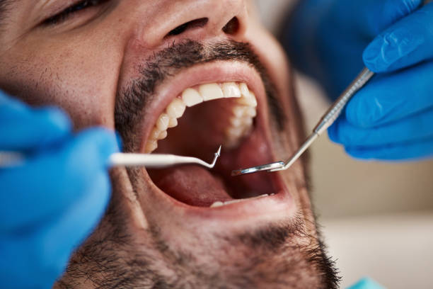 Professional Emergency Dentist in SD